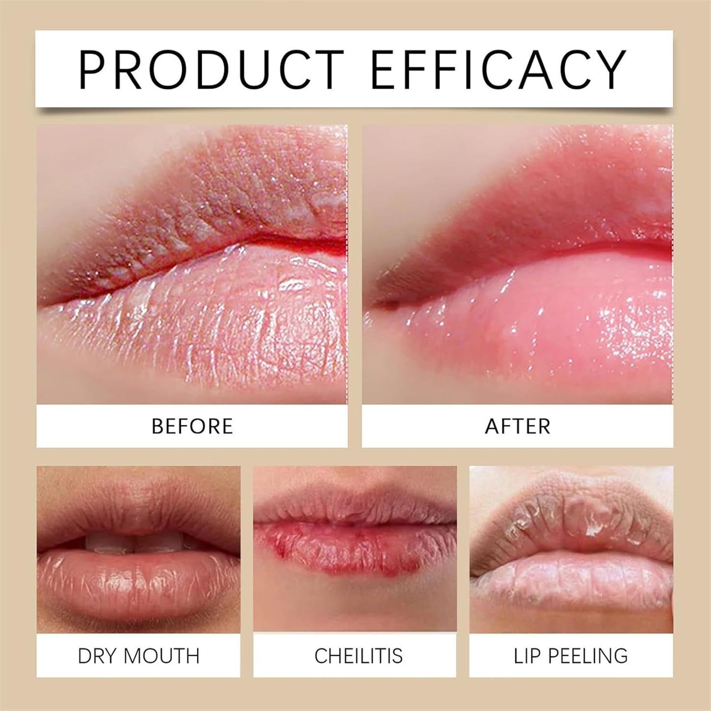 Luhaka®Reedle Shot Lip Plumperr - K-Beauty Tech