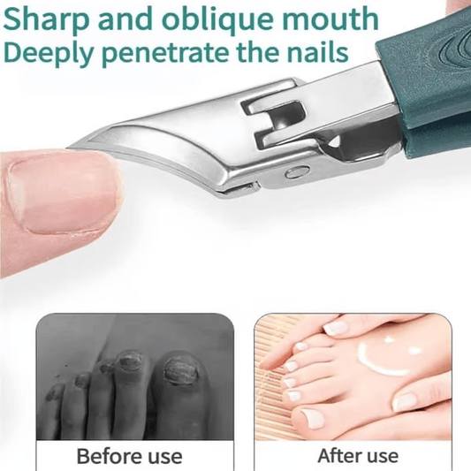 DAFEILA®🔥Eagle Beak Angled Nail Clippers 3-Piece Set