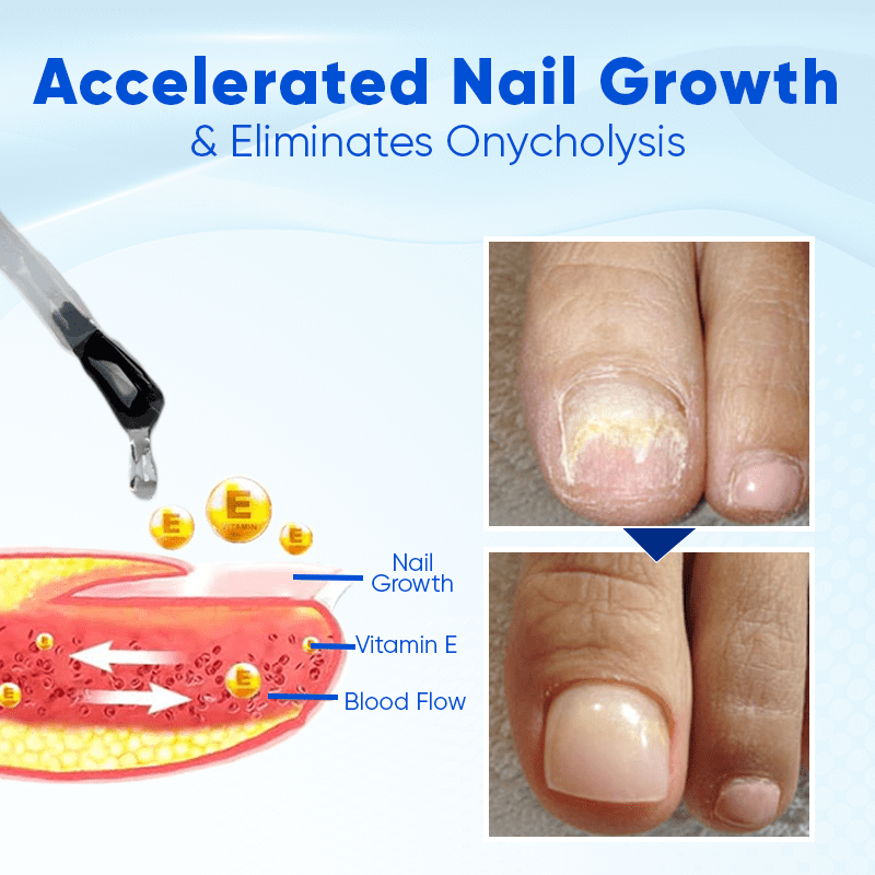 Blanoat® OnyxoGuard Nail Growth and Repair Serum 00