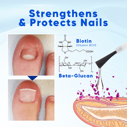 Blanoat® OnyxoGuard Nail Growth and Repair Serum 00