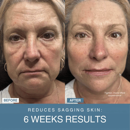Cilifer®7-in-1 LED Facial Sculptor